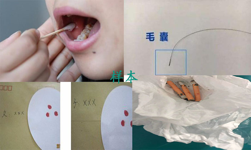 亲子鉴定需要
